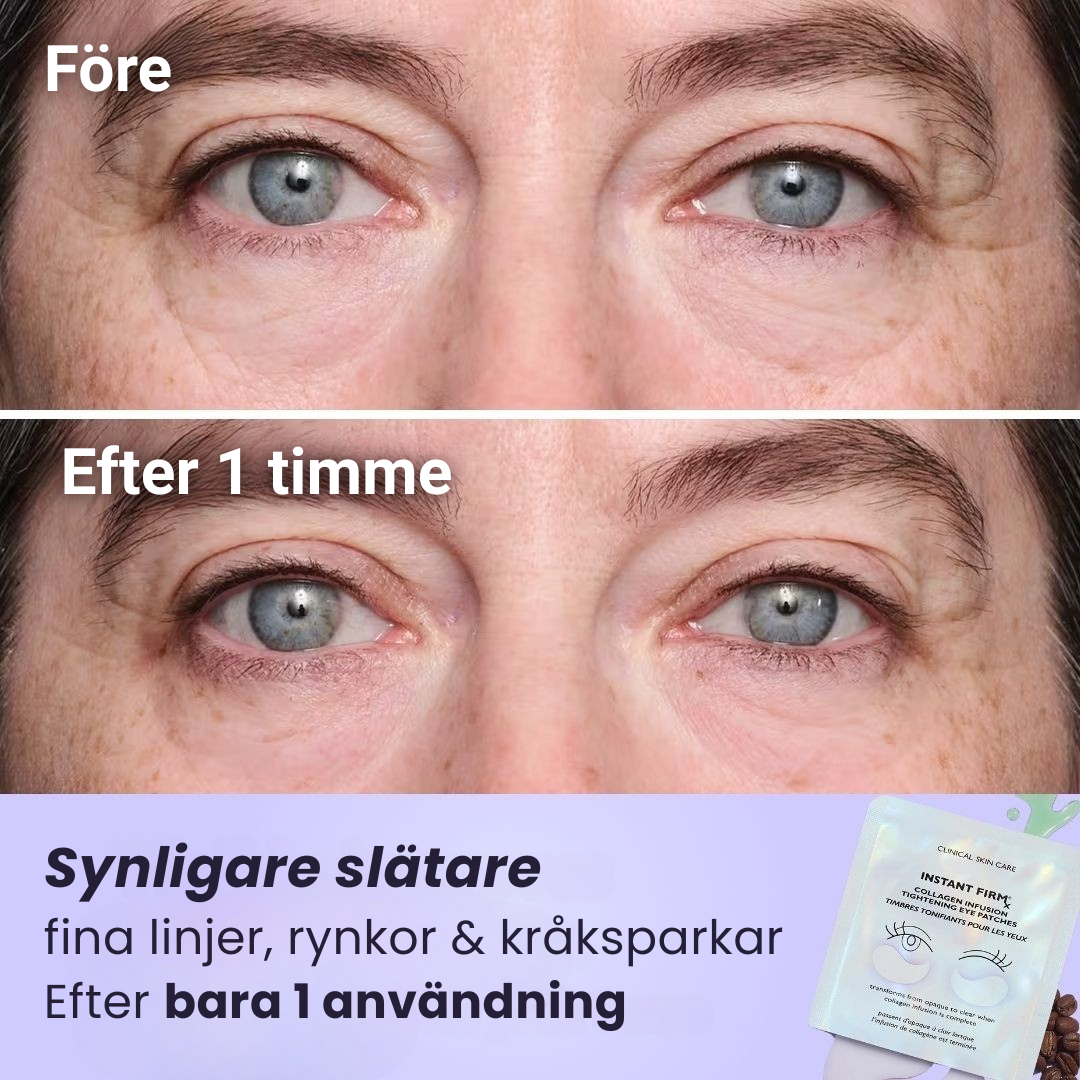 ByeBags™ - Säg hejdå till påsar under ögonen
